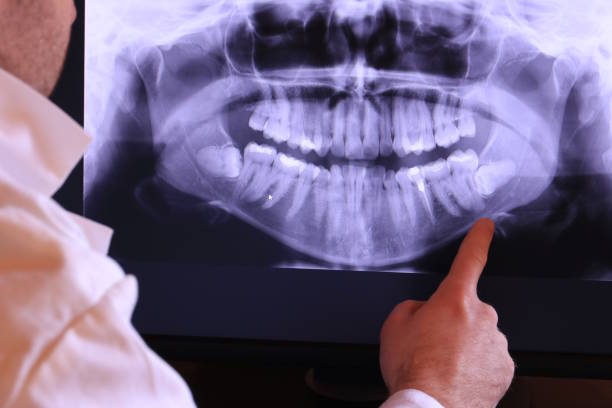 Best Emergency Dental Services for Seniors in St Robert, MO